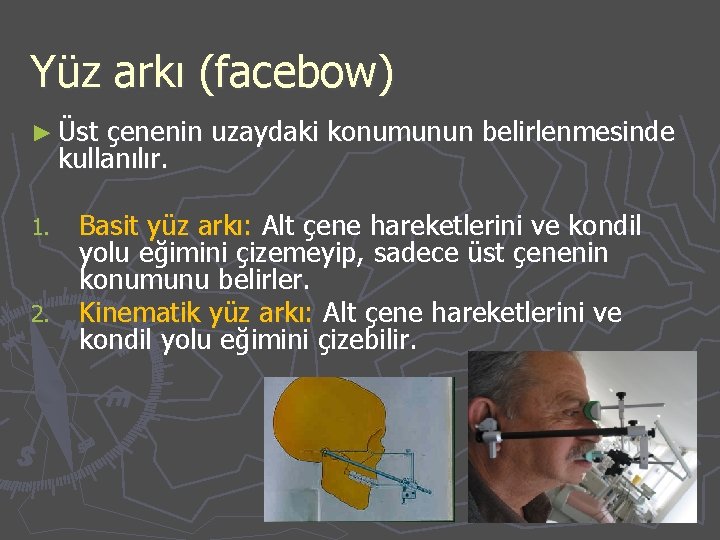 Yüz arkı (facebow) ► Üst çenenin uzaydaki konumunun belirlenmesinde kullanılır. Basit yüz arkı: Alt