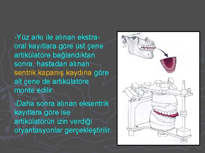 -Yüz arkı ile alınan ekstraoral kayıtlara göre üst çene artikülatöre bağlandıktan sonra, hastadan alınan