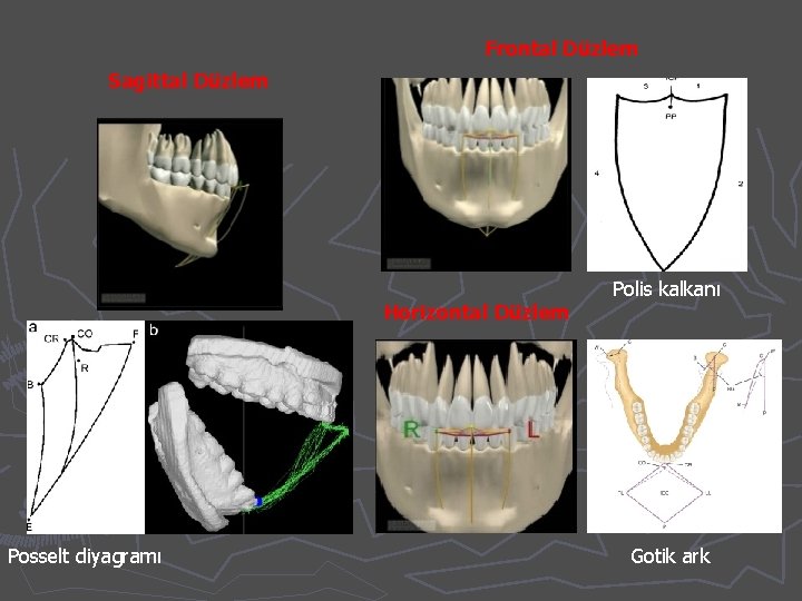 Frontal Düzlem Sagittal Düzlem Horizontal Düzlem Posselt diyagramı Polis kalkanı Gotik ark 