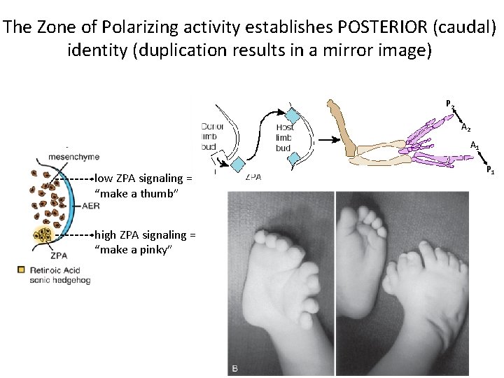 The Zone of Polarizing activity establishes POSTERIOR (caudal) identity (duplication results in a mirror