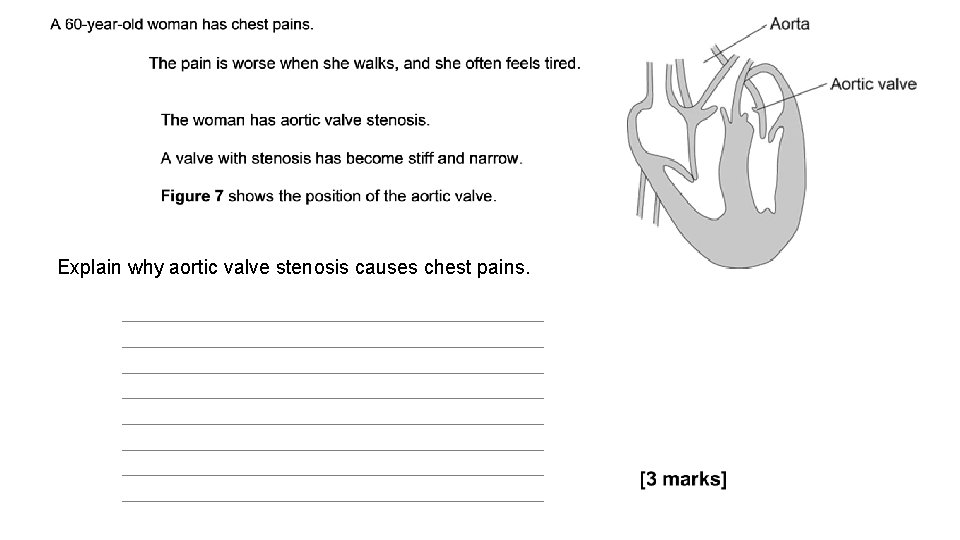 Explain why aortic valve stenosis causes chest pains. 