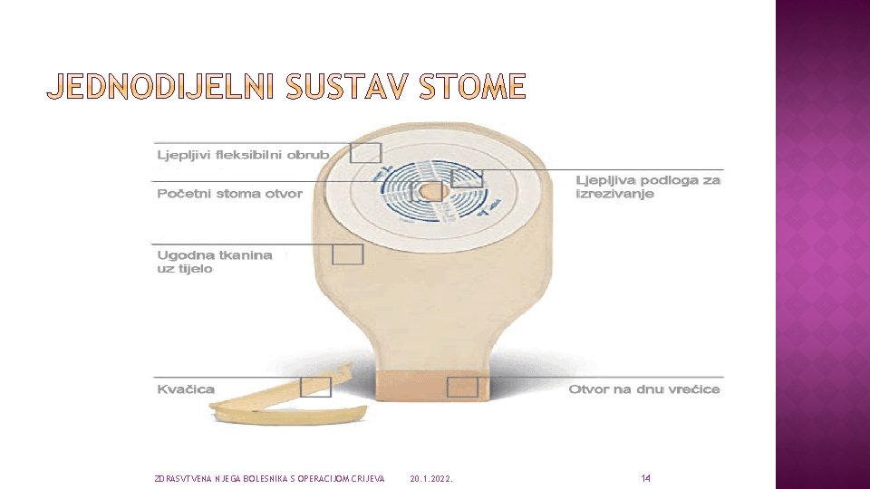 ZDRASVTVENA NJEGA BOLESNIKA S OPERACIJOM CRIJEVA 20. 1. 2022. 14 