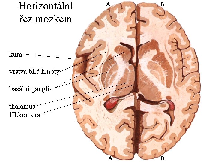 Horizontální řez mozkem kůra vrstva bílé hmoty basální ganglia thalamus III. komora 