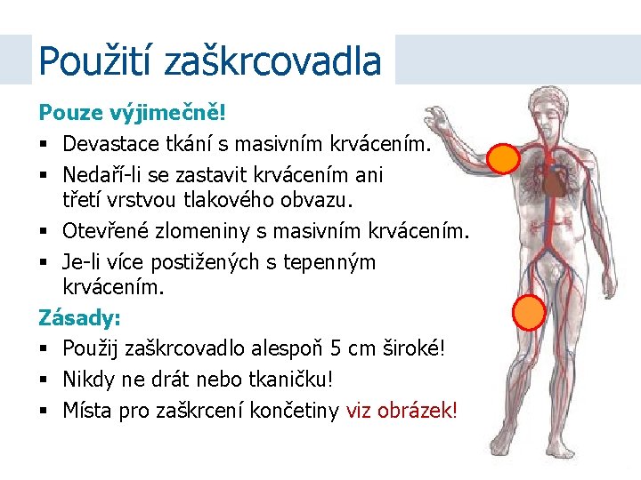 Použití zaškrcovadla Pouze výjimečně! Devastace tkání s masivním krvácením. Nedaří-li se zastavit krvácením ani