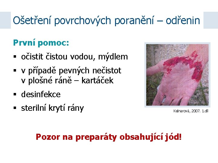 Ošetření povrchových poranění – odřenin První pomoc: očistit čistou vodou, mýdlem v případě pevných