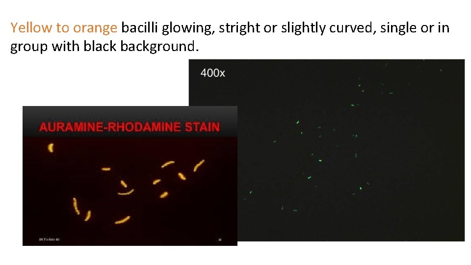 Yellow to orange bacilli glowing, stright or slightly curved, single or in group with