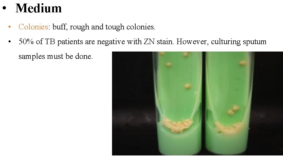  • Medium • Colonies: buff, rough and tough colonies. • 50% of TB
