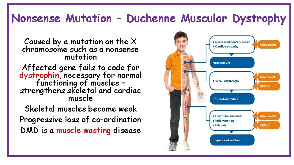 Nonsense Mutation – Duchenne Muscular Dystrophy Caused by a mutation on the X chromosome