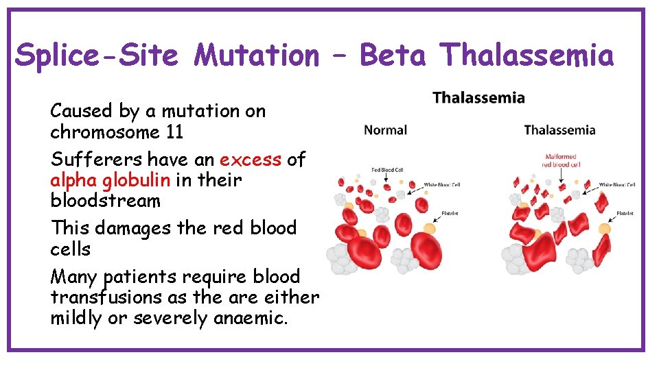 Splice-Site Mutation – Beta Thalassemia Caused by a mutation on chromosome 11 Sufferers have