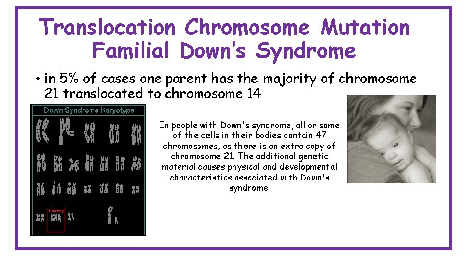 Translocation Chromosome Mutation Familial Down’s Syndrome • in 5% of cases one parent has