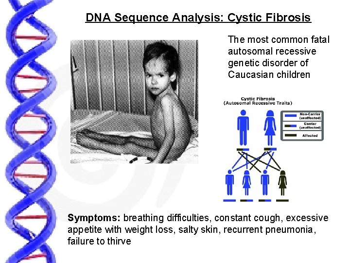 DNA Sequence Analysis: Cystic Fibrosis The most common fatal autosomal recessive genetic disorder of