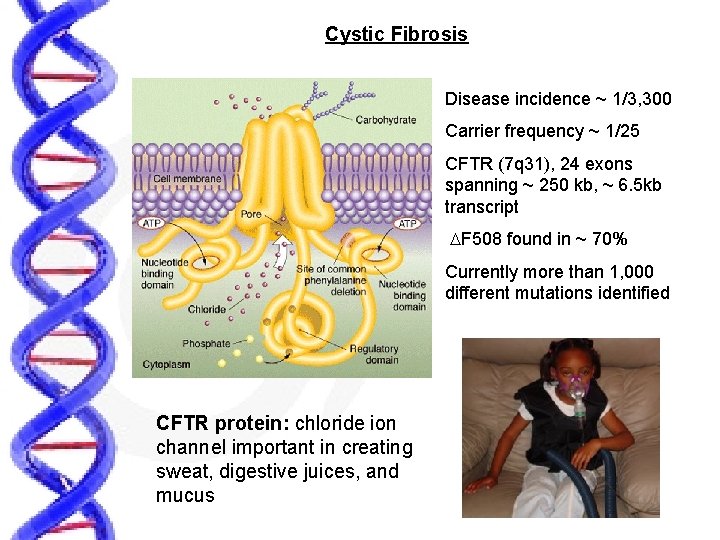 Cystic Fibrosis Disease incidence ~ 1/3, 300 Carrier frequency ~ 1/25 CFTR (7 q