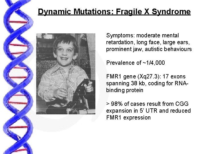 Dynamic Mutations: Fragile X Syndrome Symptoms: moderate mental retardation, long face, large ears, prominent