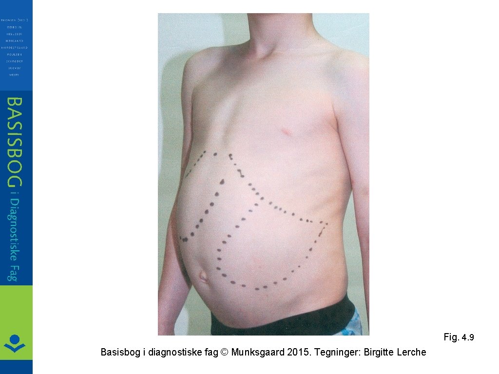 Fig. 4. 9 Basisbog i diagnostiske fag © Munksgaard 2015. Tegninger: Birgitte Lerche 