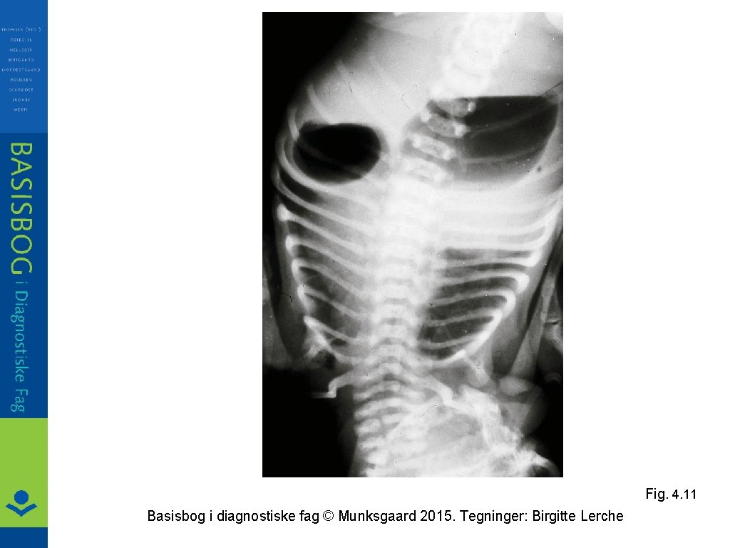 Fig. 4. 11 Basisbog i diagnostiske fag © Munksgaard 2015. Tegninger: Birgitte Lerche 