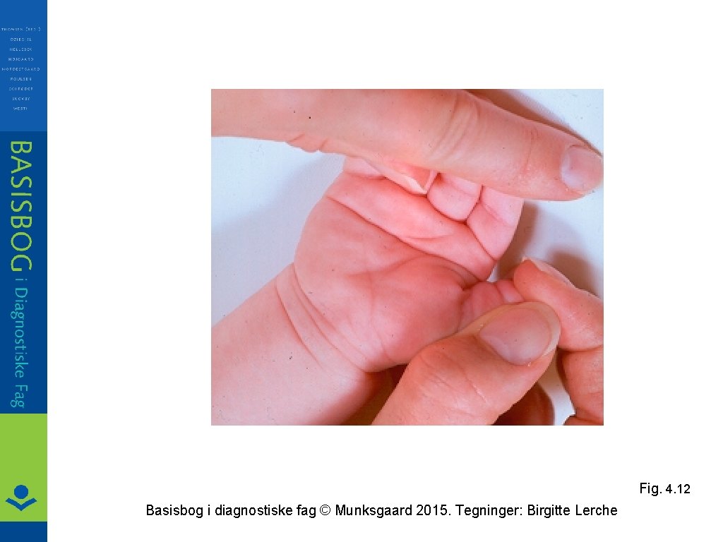 Fig. 4. 12 Basisbog i diagnostiske fag © Munksgaard 2015. Tegninger: Birgitte Lerche 