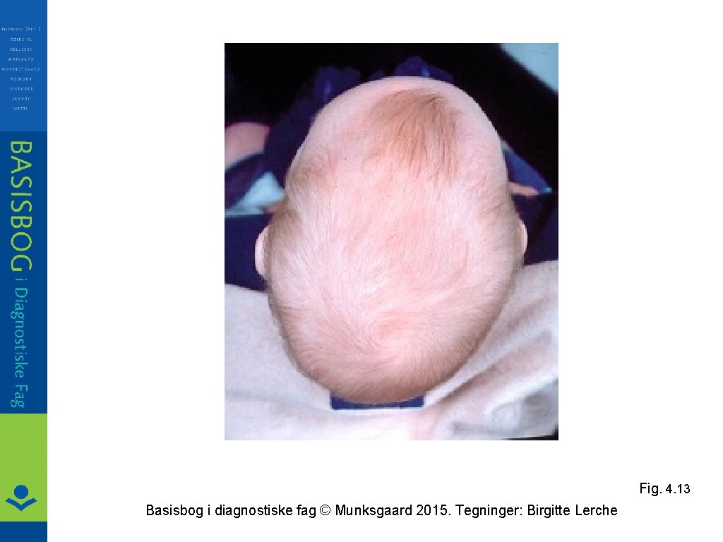 Fig. 4. 13 Basisbog i diagnostiske fag © Munksgaard 2015. Tegninger: Birgitte Lerche 