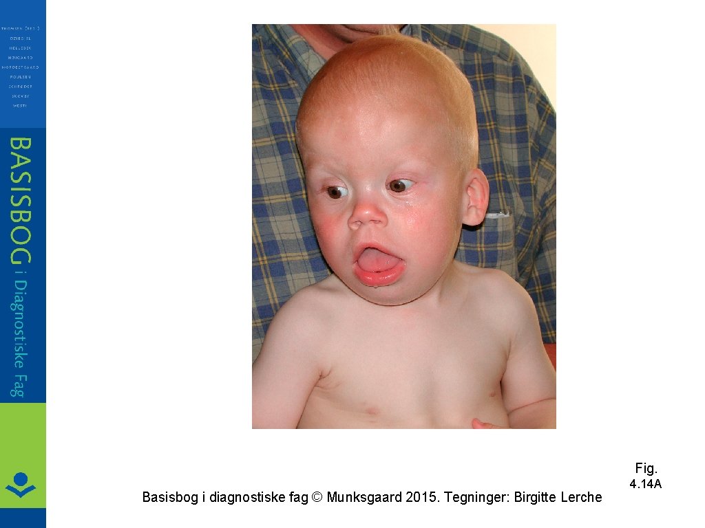 Fig. Basisbog i diagnostiske fag © Munksgaard 2015. Tegninger: Birgitte Lerche 4. 14 A