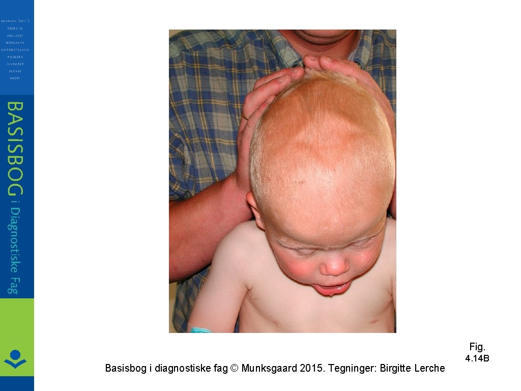 Fig. Basisbog i diagnostiske fag © Munksgaard 2015. Tegninger: Birgitte Lerche 4. 14 B