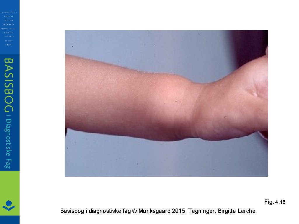 Fig. 4. 15 Basisbog i diagnostiske fag © Munksgaard 2015. Tegninger: Birgitte Lerche 