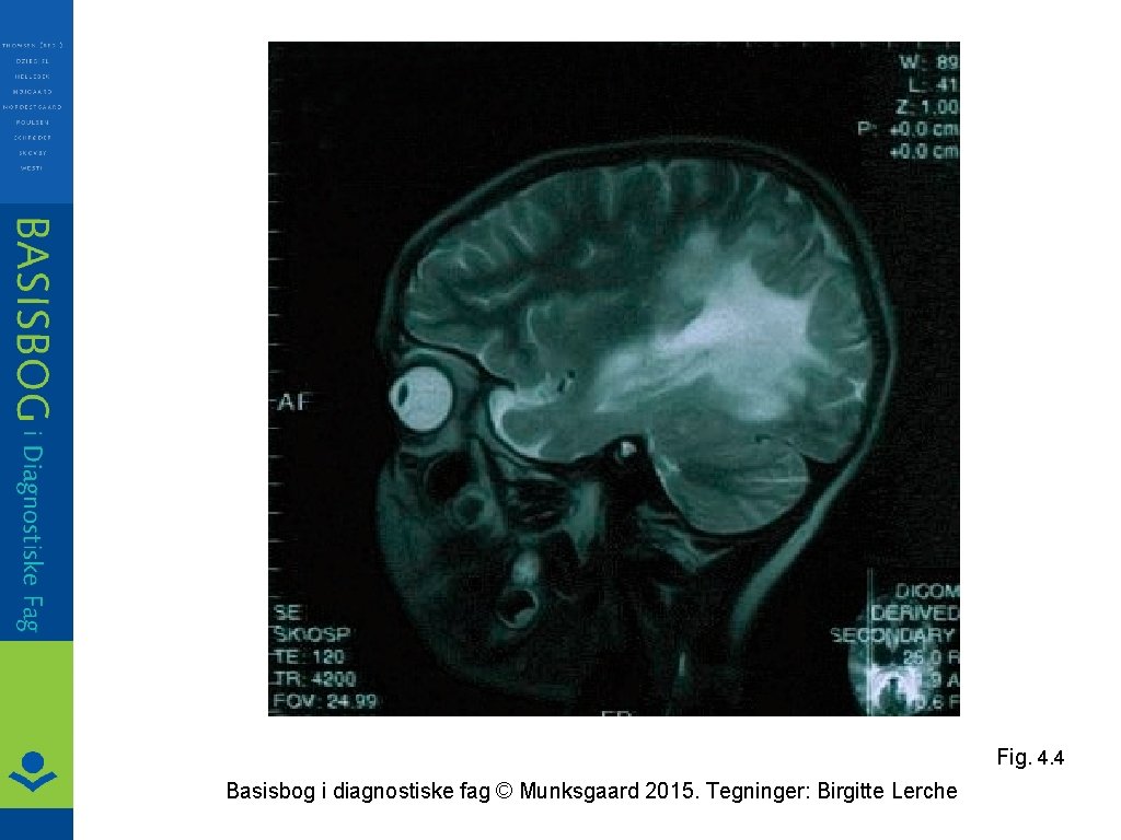 Fig. 4. 4 Basisbog i diagnostiske fag © Munksgaard 2015. Tegninger: Birgitte Lerche 
