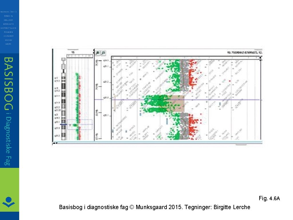 Fig. 4. 6 A Basisbog i diagnostiske fag © Munksgaard 2015. Tegninger: Birgitte Lerche