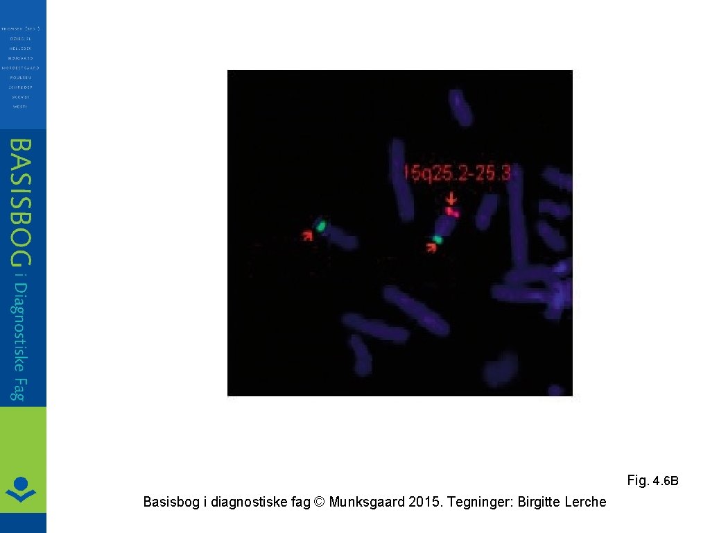 Fig. 4. 6 B Basisbog i diagnostiske fag © Munksgaard 2015. Tegninger: Birgitte Lerche