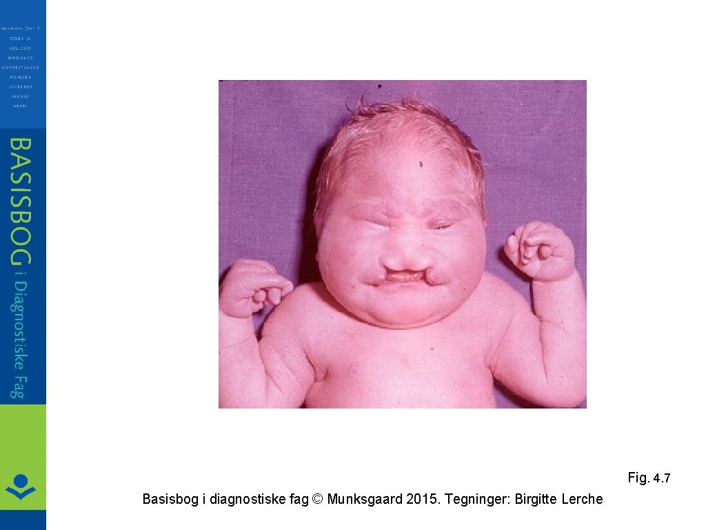 Fig. 4. 7 Basisbog i diagnostiske fag © Munksgaard 2015. Tegninger: Birgitte Lerche 