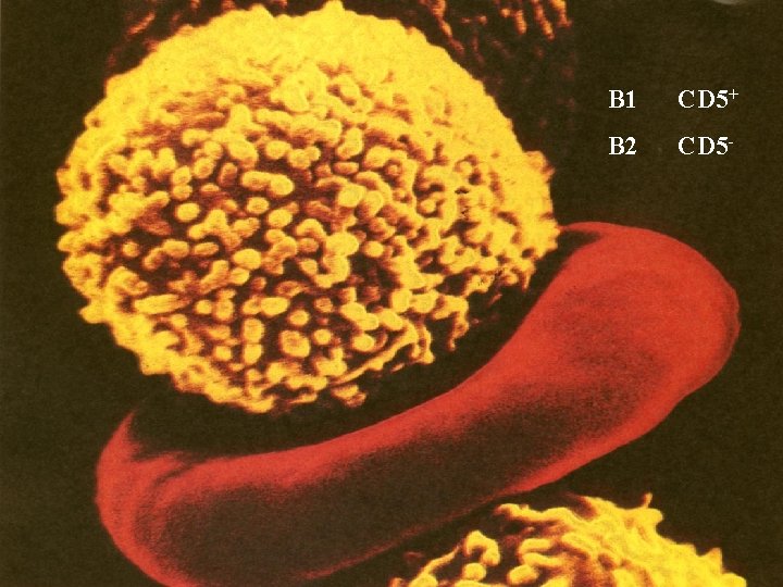 B 1 CD 5+ B 2 CD 5 - 