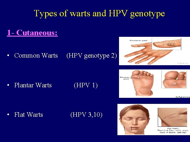 Types of warts and HPV genotype 1 - Cutaneous: • Common Warts • Plantar