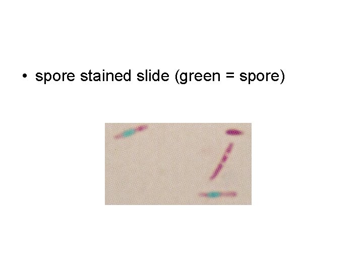  • spore stained slide (green = spore) 