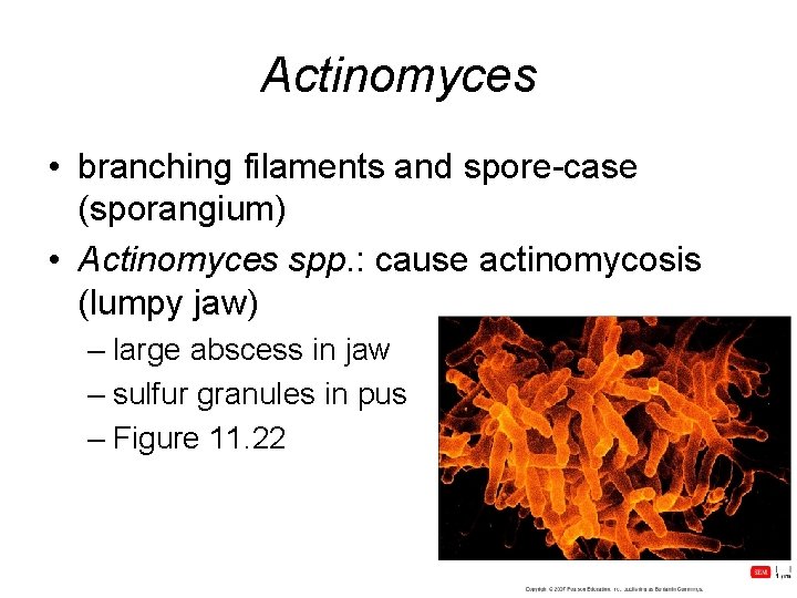 Actinomyces • branching filaments and spore-case (sporangium) • Actinomyces spp. : cause actinomycosis (lumpy