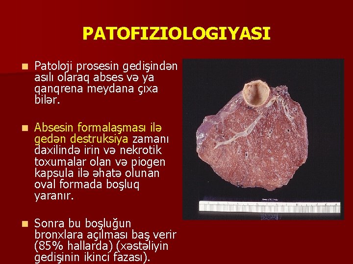 PATOFIZIOLOGIYASI n Patoloji prosesin gedişindən asılı olaraq abses və ya qanqrena meydana çıxa bilər.