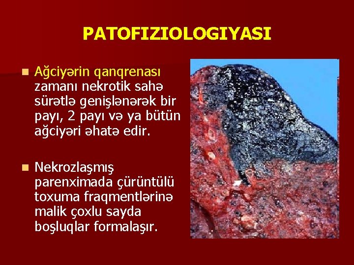 PATOFIZIOLOGIYASI n Ağciyərin qanqrenası zamanı nekrotik sahə sürətlə genişlənərək bir payı, 2 payı və