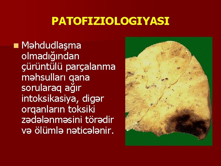 PATOFIZIOLOGIYASI n Məhdudlaşma olmadığından çürüntülü parçalanma məhsulları qana sorularaq ağır intoksikasiya, digər orqanların toksiki