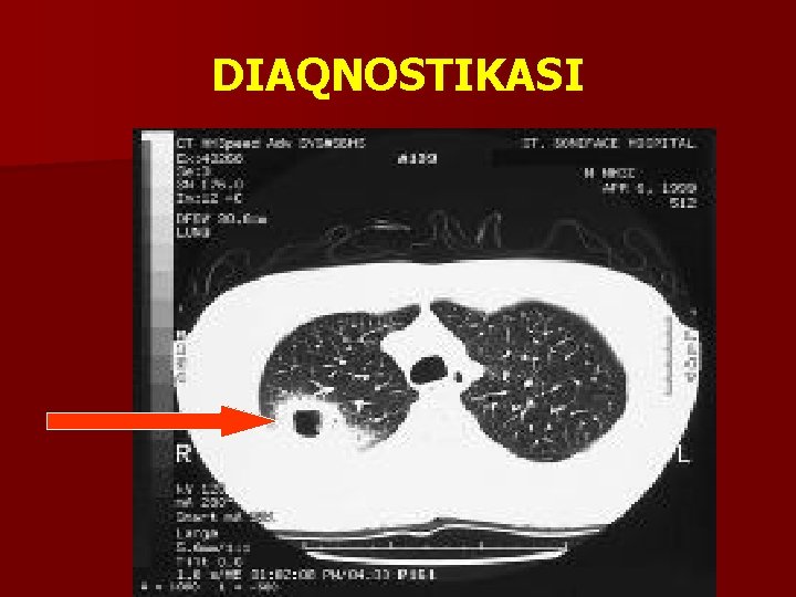 DIAQNOSTIKASI 