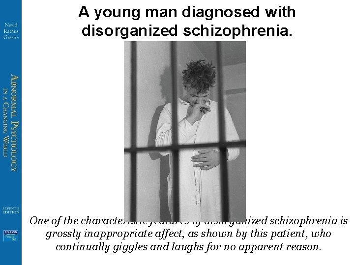 A young man diagnosed with disorganized schizophrenia. One of the characteristic features of disorganized