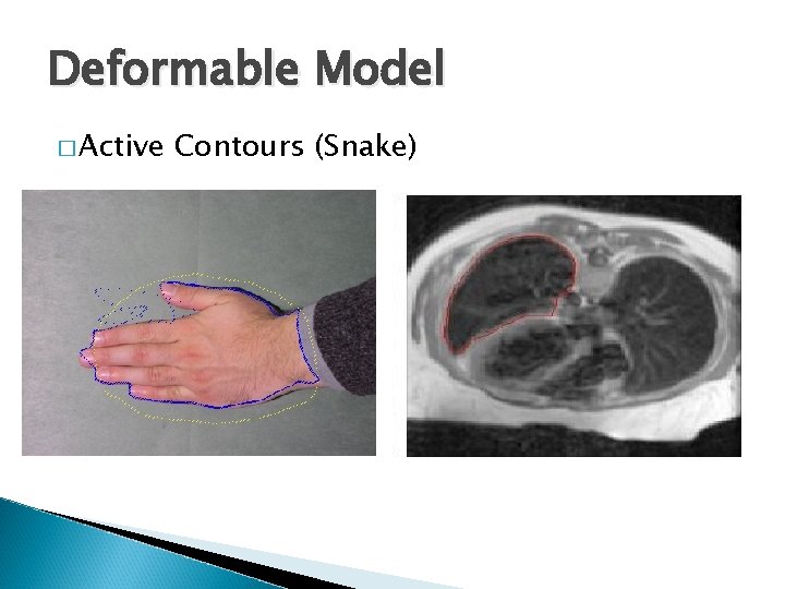Deformable Model � Active Contours (Snake) Deformable Model � Active Contours (Snake)