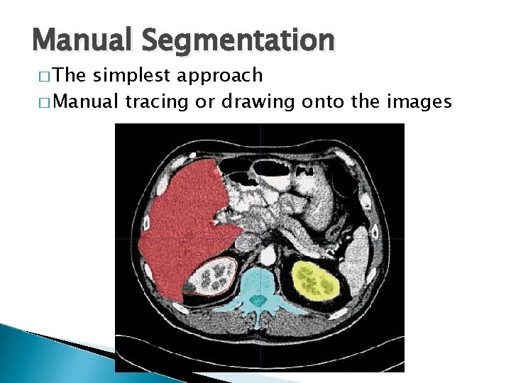 Manual Segmentation � The simplest approach � Manual tracing or drawing onto the images Manual Segmentation � The simplest approach � Manual tracing or drawing onto the images