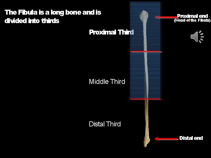 The Fibula is a long bone and is divided into thirds Proximal end (Head