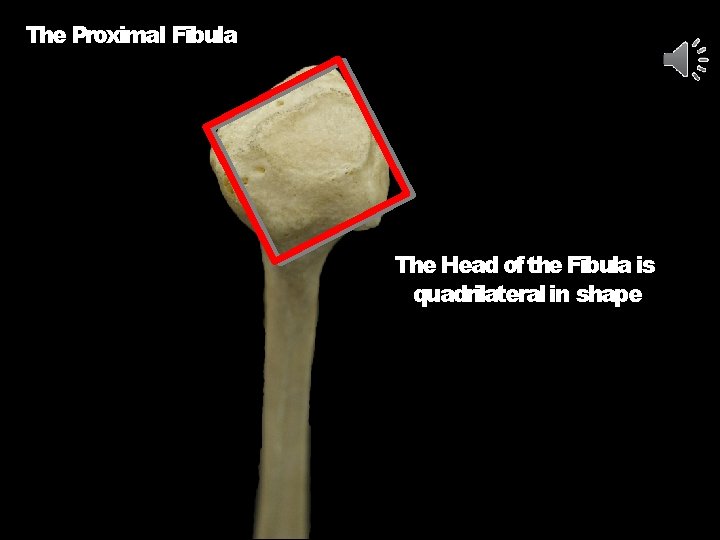 The Proximal Fibula The Head of the Fibula is quadrilateral in shape 