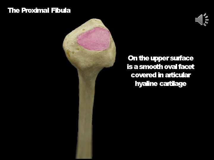 The Proximal Fibula On the upper surface is a smooth oval facet covered in