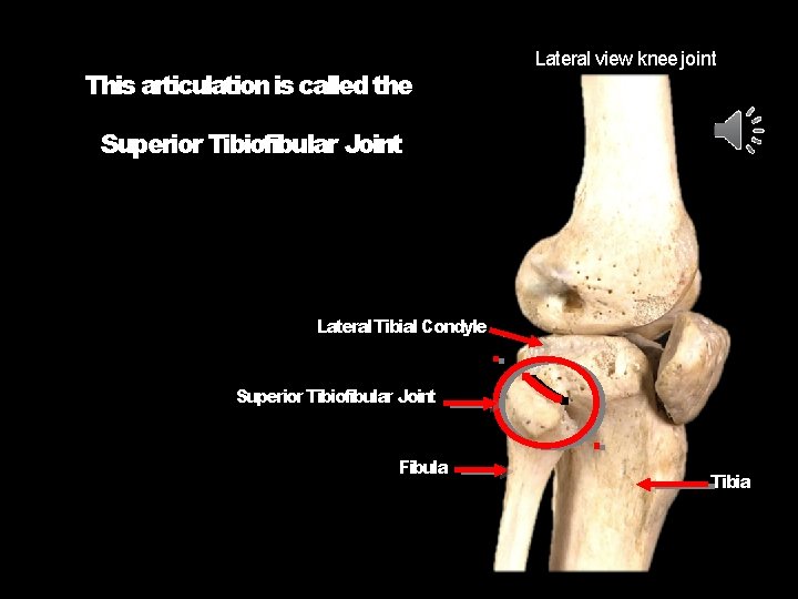 This articulation is called the Lateral view knee joint Superior Tibiofibular Joint Lateral Tibial