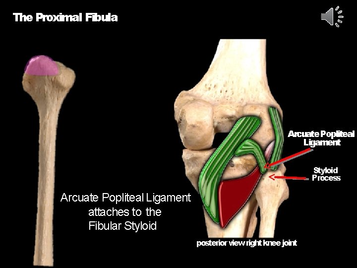 The Proximal Fibula Arcuate Popliteal Ligament Styloid Process Arcuate Popliteal Ligament attaches to the
