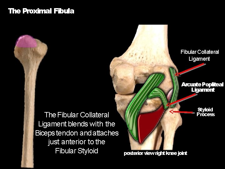 The Proximal Fibular Collateral Ligament Arcuate Popliteal Ligament The Fibular Collateral Ligament blends with