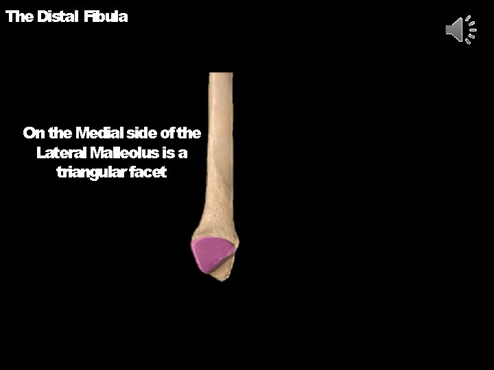 The Distal Fibula On the Medial side of the Lateral Malleolus is a triangular