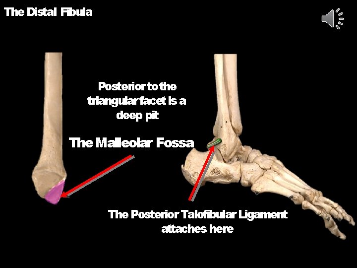 The Distal Fibula Posterior to the triangular facet is a deep pit The Malleolar