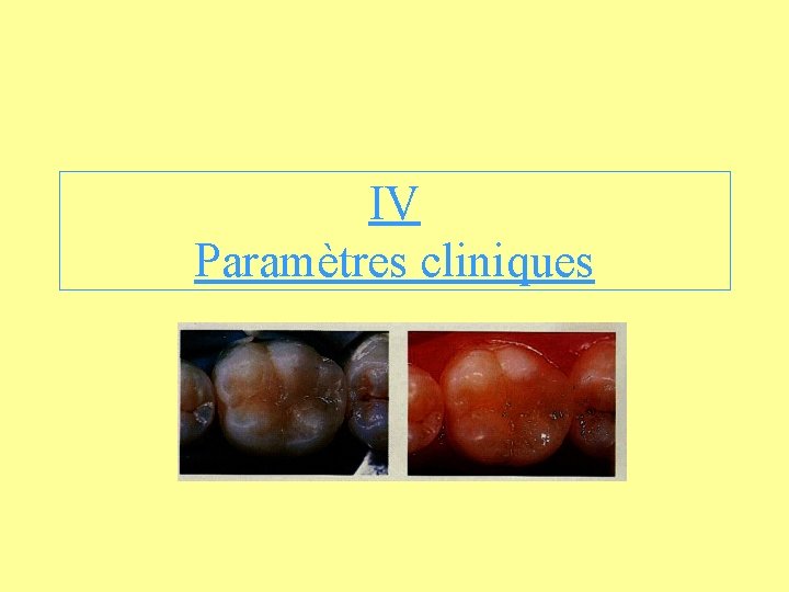 IV Paramètres cliniques 