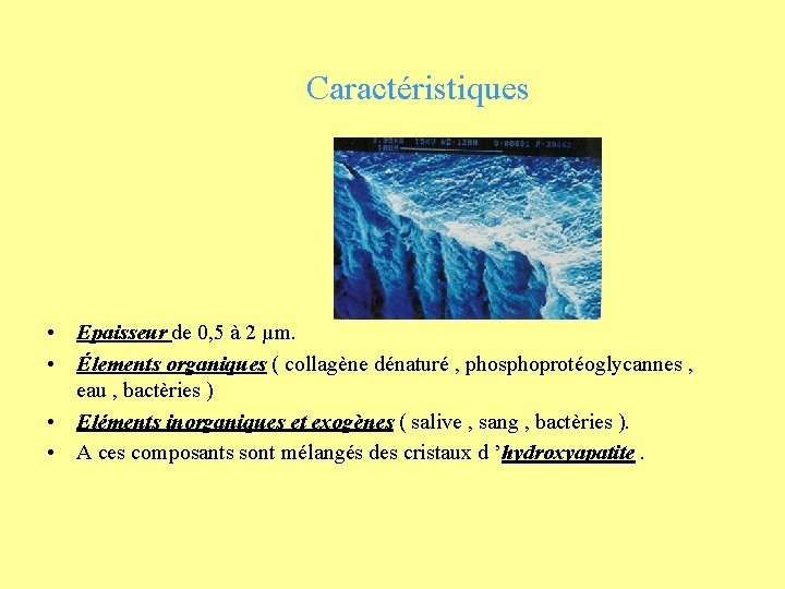 Caractéristiques • Epaisseur de 0, 5 à 2 µm. • Élements organiques ( collagène