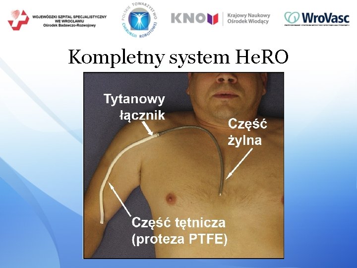 Kompletny system He. RO 